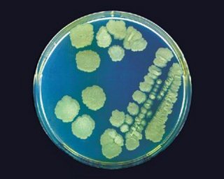 I undersøgelsen blev Bt-bakterierne talt efter vækst på agar i petriskåle, hvor de danner synlige kolonier. Foto: AU